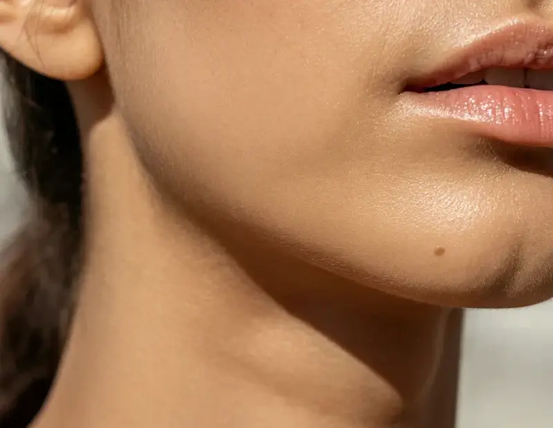 My Glowing Skin Before & After: Clear, Dewy Complexion Transformation