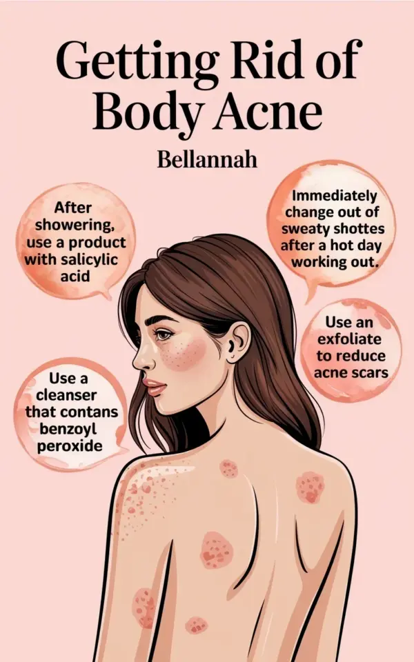 Getting Rid of Body Acne with Salicylic Acid Cleanser Tips